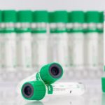 10034000 Пробирки вакуумные "Acti-Fine" длязабора венозной крови с литий гепарином обьем 4 мл,размер 13*75 мм 50шт/уп Гранат,Россия